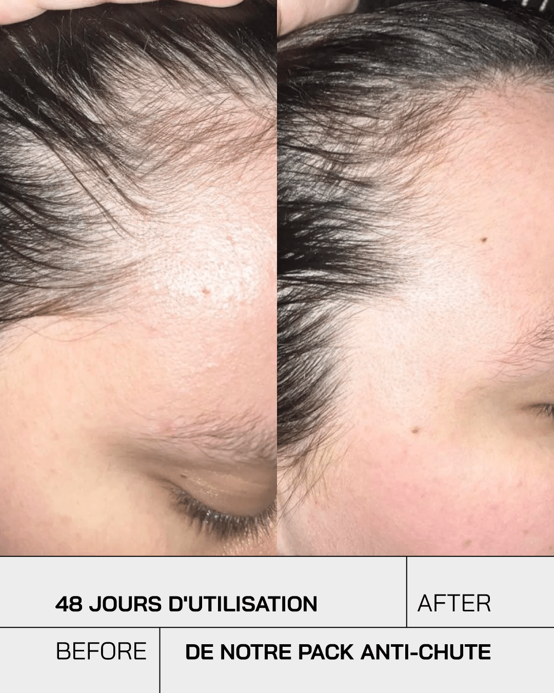 Pack Anti Chute Touché - Touché Skincare Lab