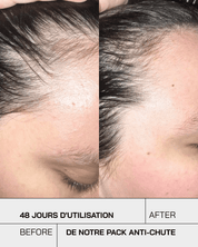 Pack Anti Chute Touché - Touché Skincare Lab