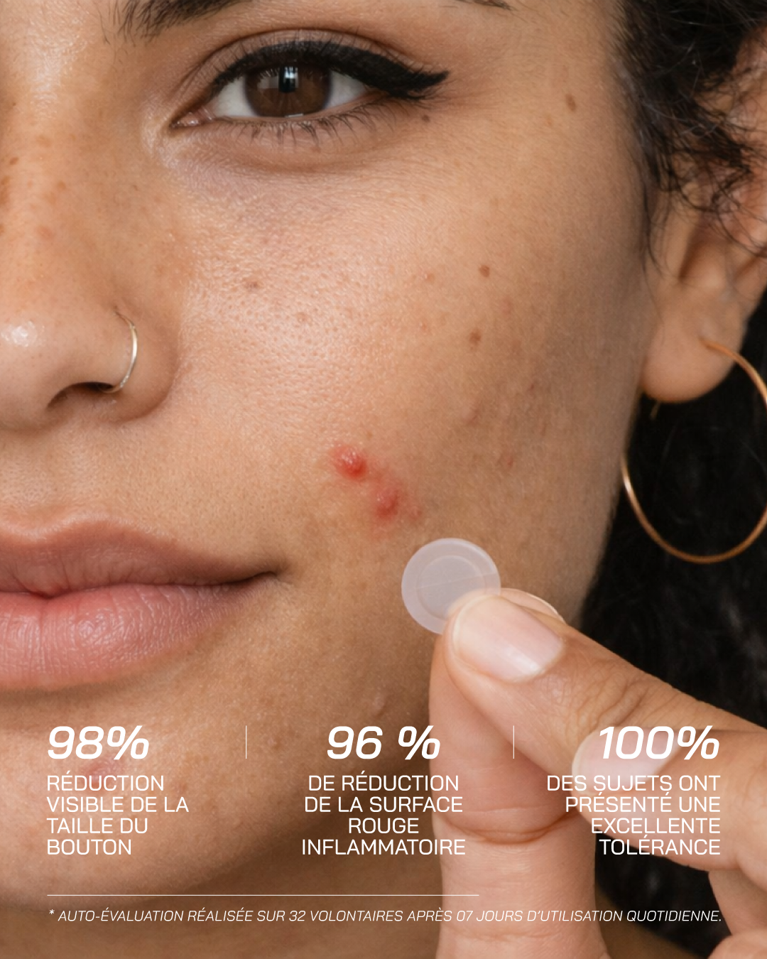 Micro-Dart Pimple Patches - Touché Skincare Lab