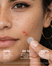 Micro-Dart Pimple Patches - Touché Skincare Lab