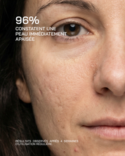 ACIDE HYALURONIQUE + NIACINAMIDE ULTRA PURE · HIGH POTENCY [Peaux sensibles] - Touché Skincare Lab