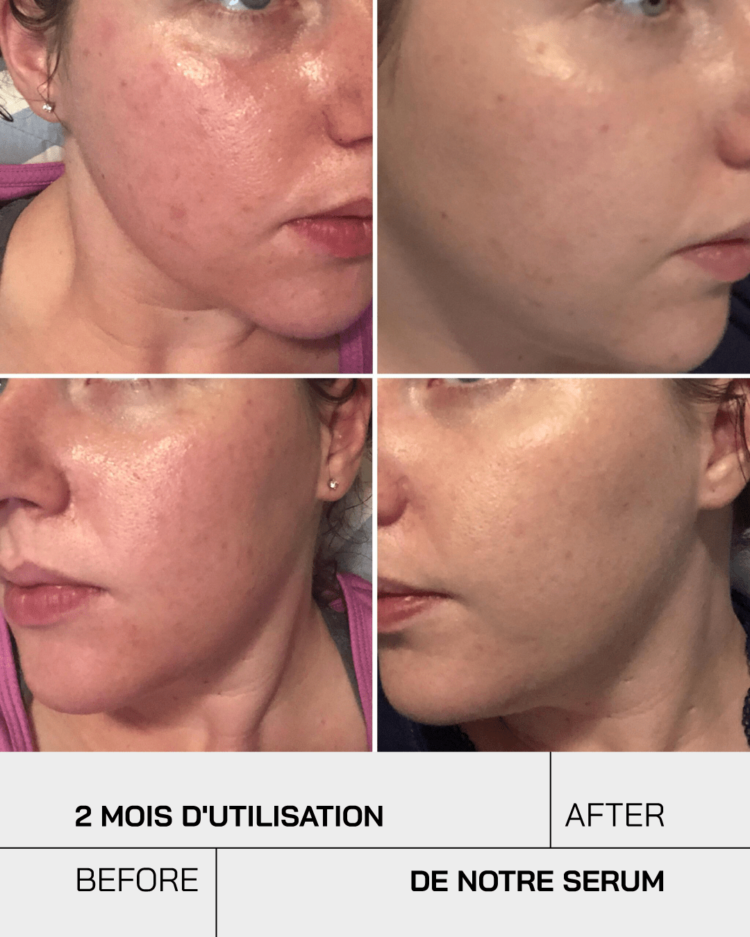 Acide Salicylique - Touché Skincare Lab