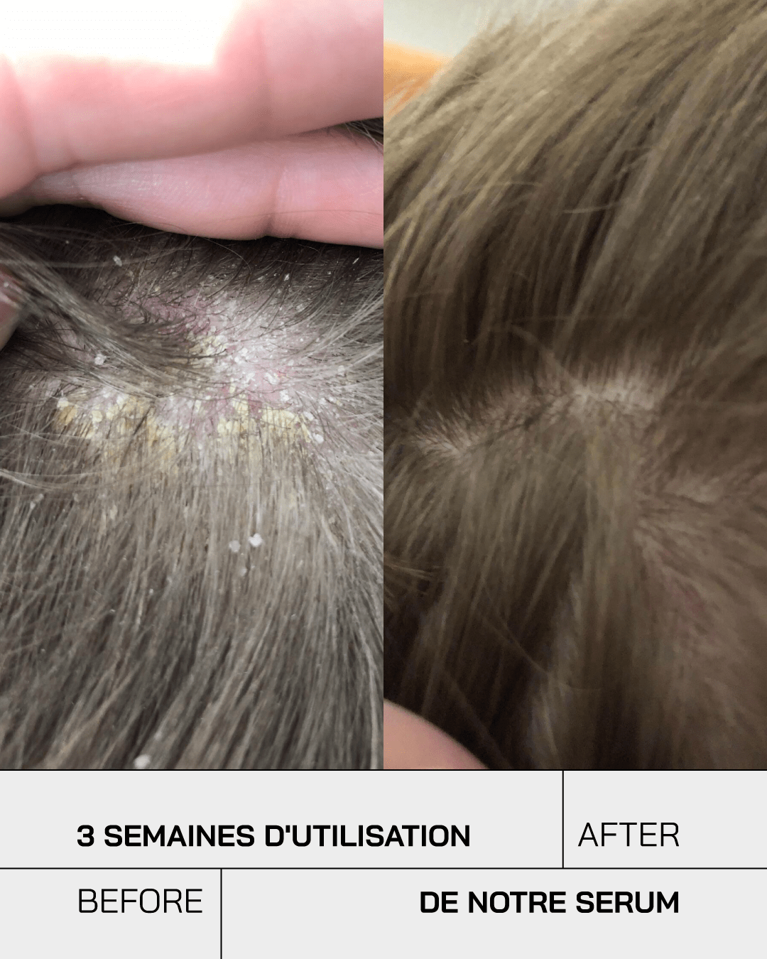 Anti-Irritations - Touché Skincare Lab