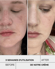 Crème hydratante visage - Touché Skincare Lab