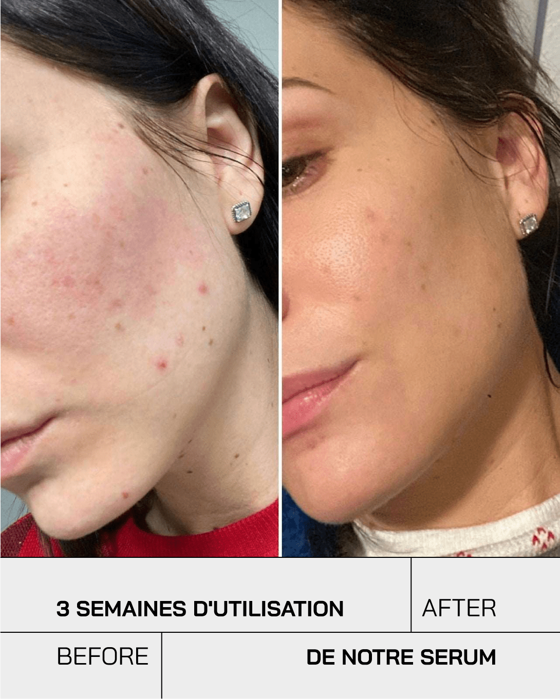 Gel hydratant acide hyaluronique 3,5% - Touché Skincare Lab
