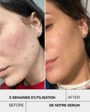 Gel hydratant acide hyaluronique 3,5% - Touché Skincare Lab
