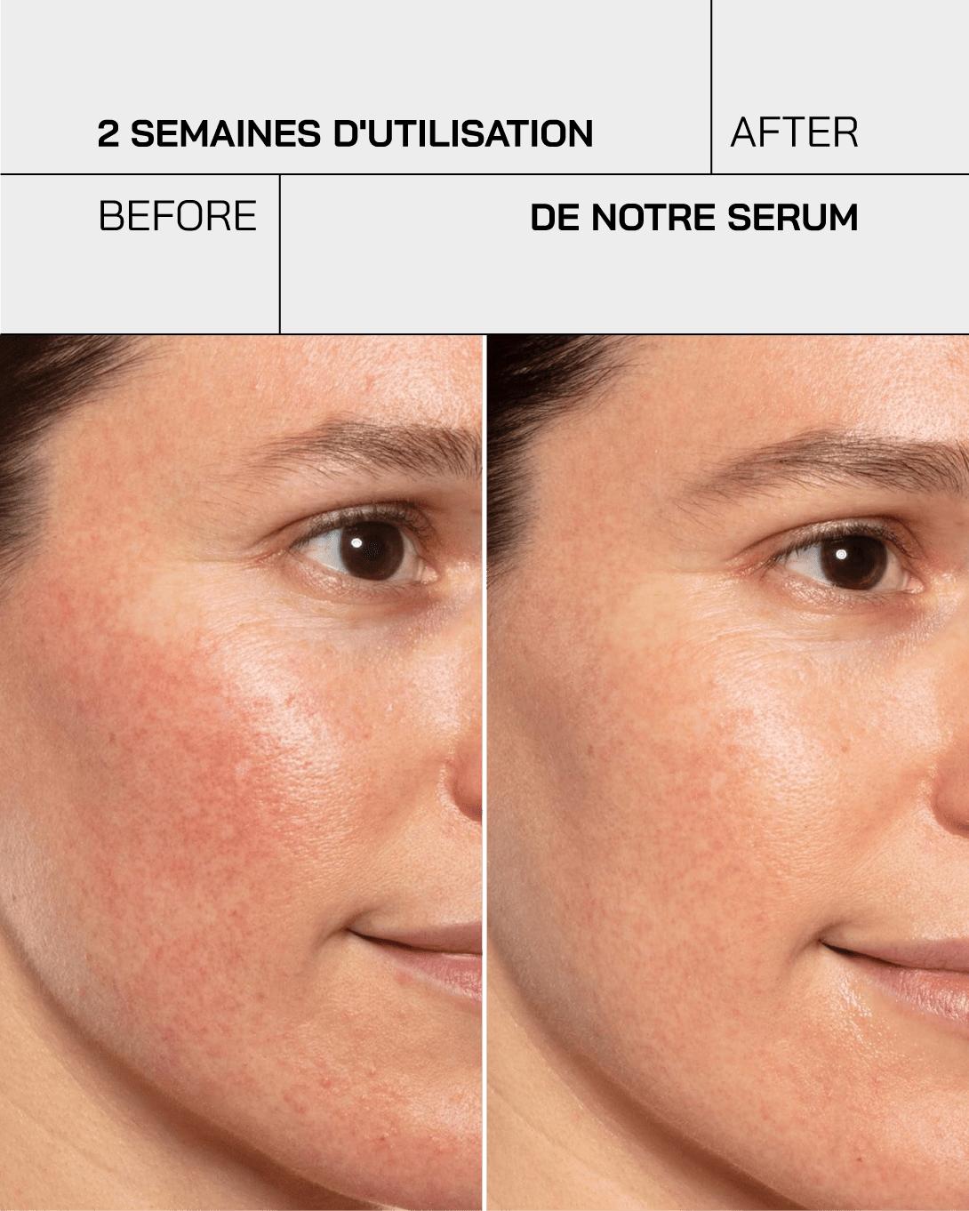 Gel hydratant acide hyaluronique 3,5% - Touché Skincare Lab