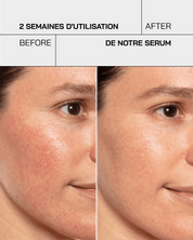 Gel hydratant acide hyaluronique 3,5% - Touché Skincare Lab