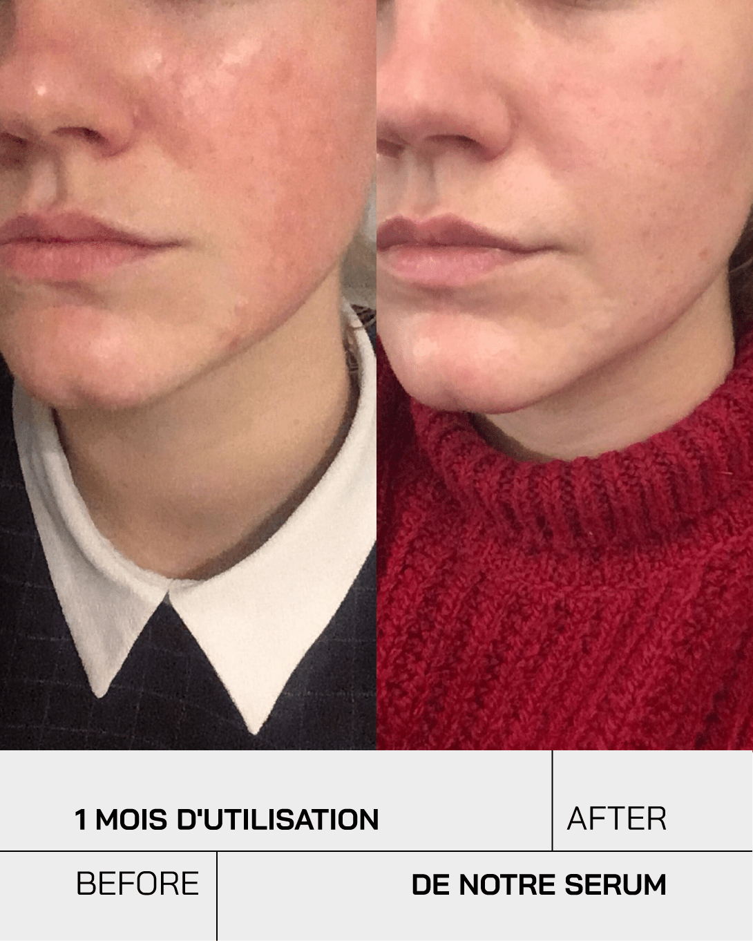 Gel hydratant acide hyaluronique 3,5% - Touché Skincare Lab