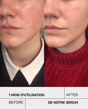 Gel hydratant acide hyaluronique 3,5% - Touché Skincare Lab