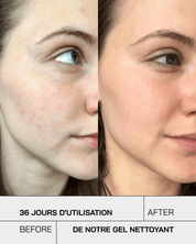 Gel Nettoyant Purifiant Visage - Touché Skincare Lab