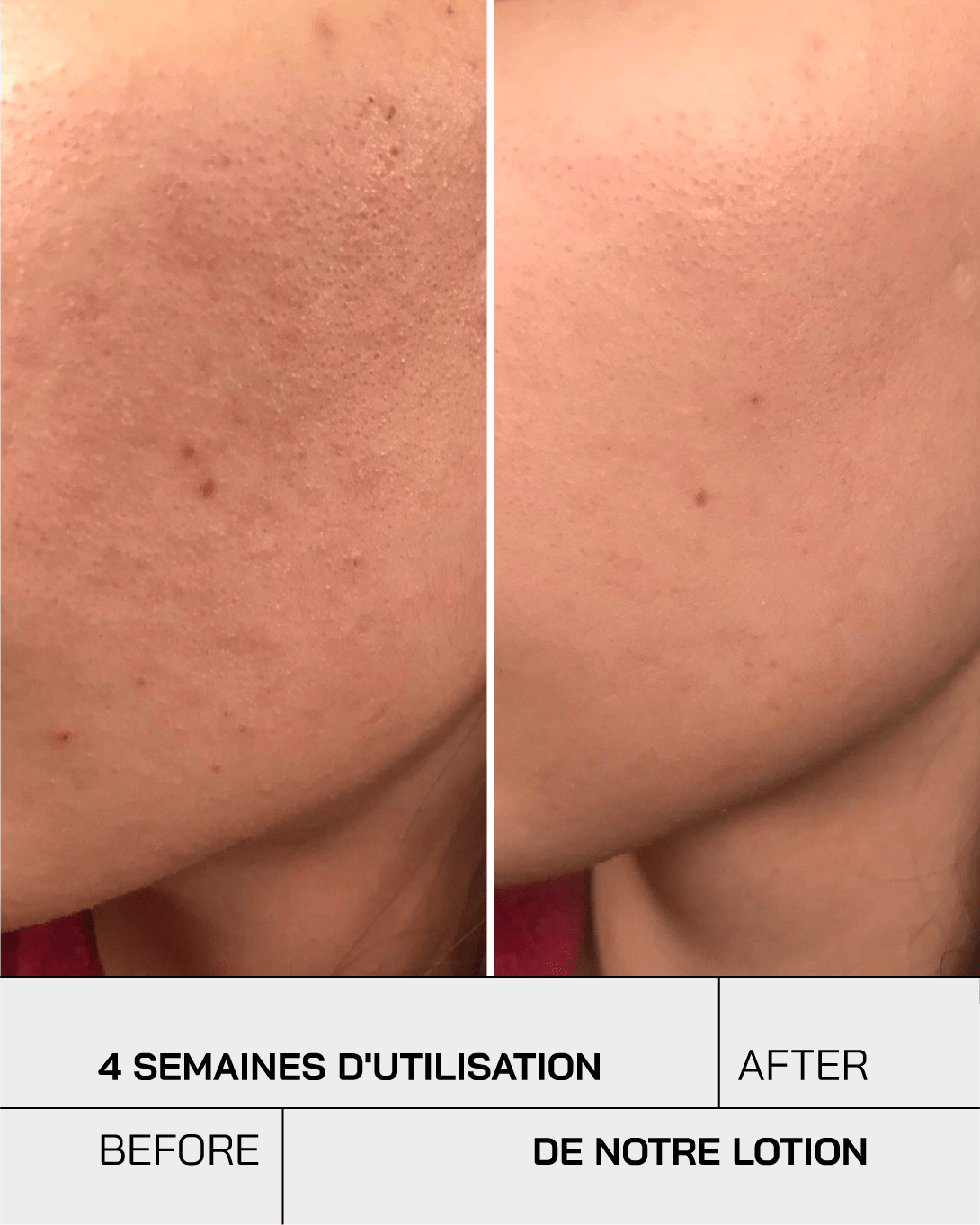 Lotion tonique - Touché Skincare Lab