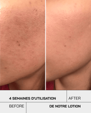 Lotion tonique - Touché Skincare Lab