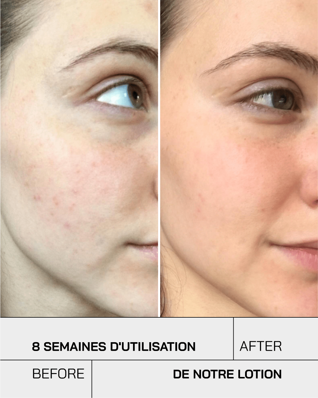 Lotion tonique - Touché Skincare Lab