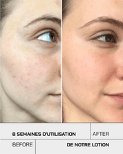 Lotion tonique - Touché Skincare Lab