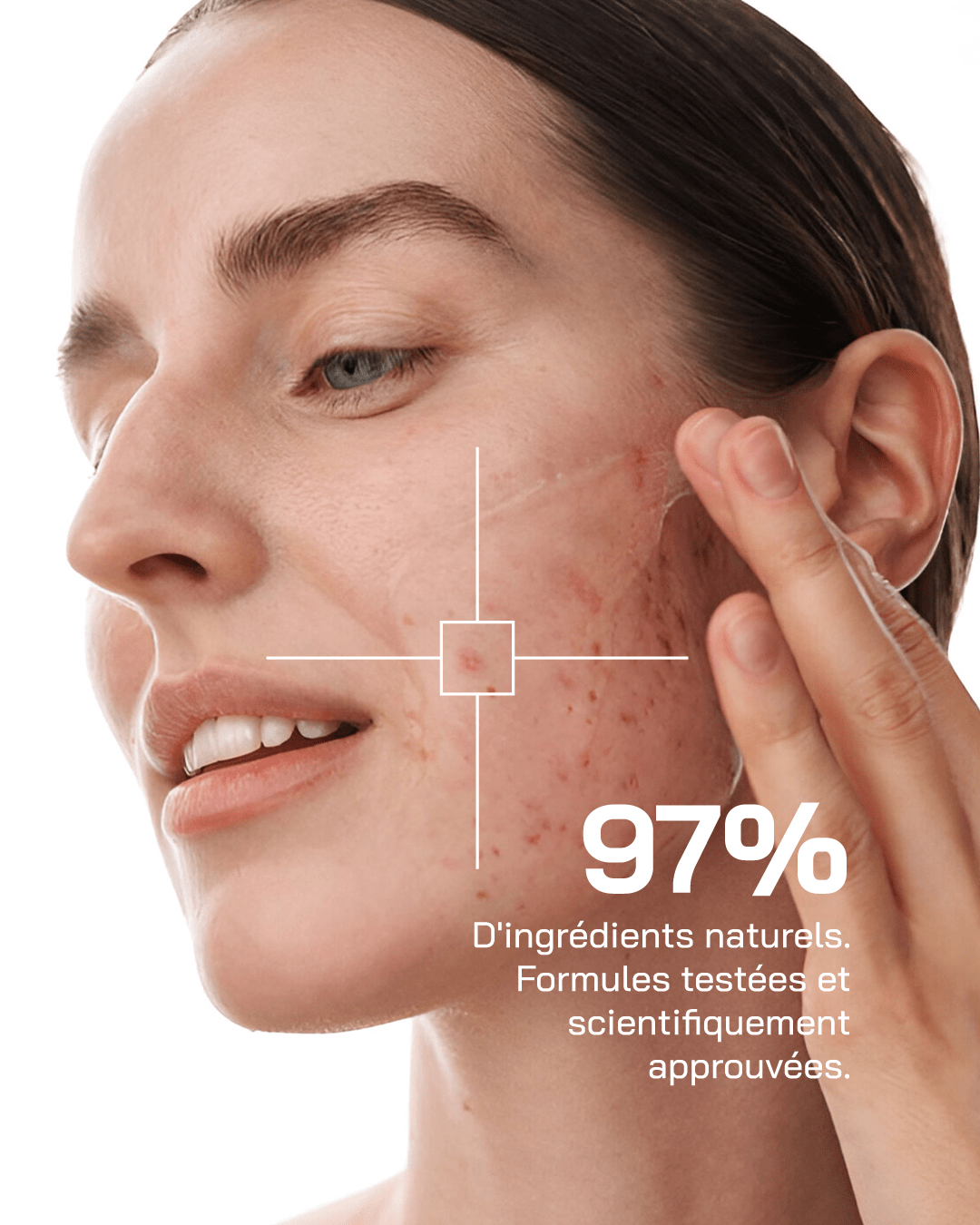 Touché Duo Anti Imperfection - Touché Skincare Lab
