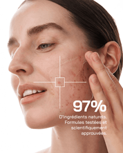 Touché Duo Anti Imperfection - Touché Skincare Lab
