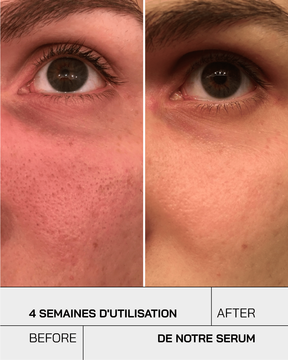 Vitamine C 11% - Touché Skincare Lab