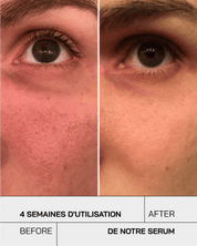 Vitamine C 11% - Touché Skincare Lab