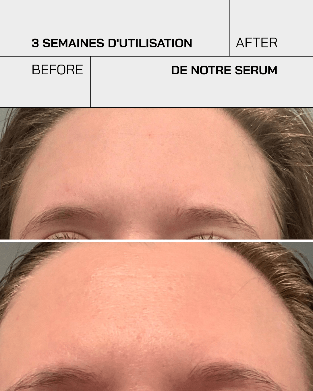 Vitamine C 11% - Touché Skincare Lab