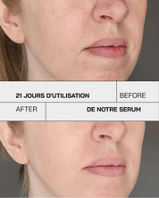 Vitamine C 11% - Touché Skincare Lab