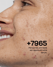 Anti Acné - Touché Skincare Lab